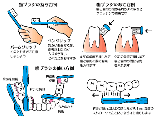 毎日磨いているつもりなのに またむし歯 どうしてなんですか むし歯について 一般社団法人 熊本県歯科医師会